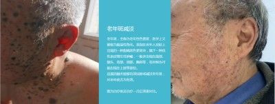 永球适温消融技术创始人 ——宁永球院长