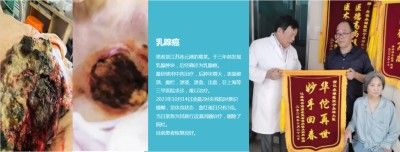 永球适温消融技术创始人 ——宁永球院长