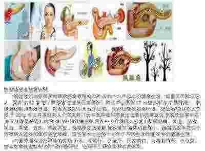 冉明医师创新国医精粹 铺就患者 “健康之路”