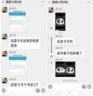 中国著名针灸专家 治疗肿瘤第一人 — 陈吉香